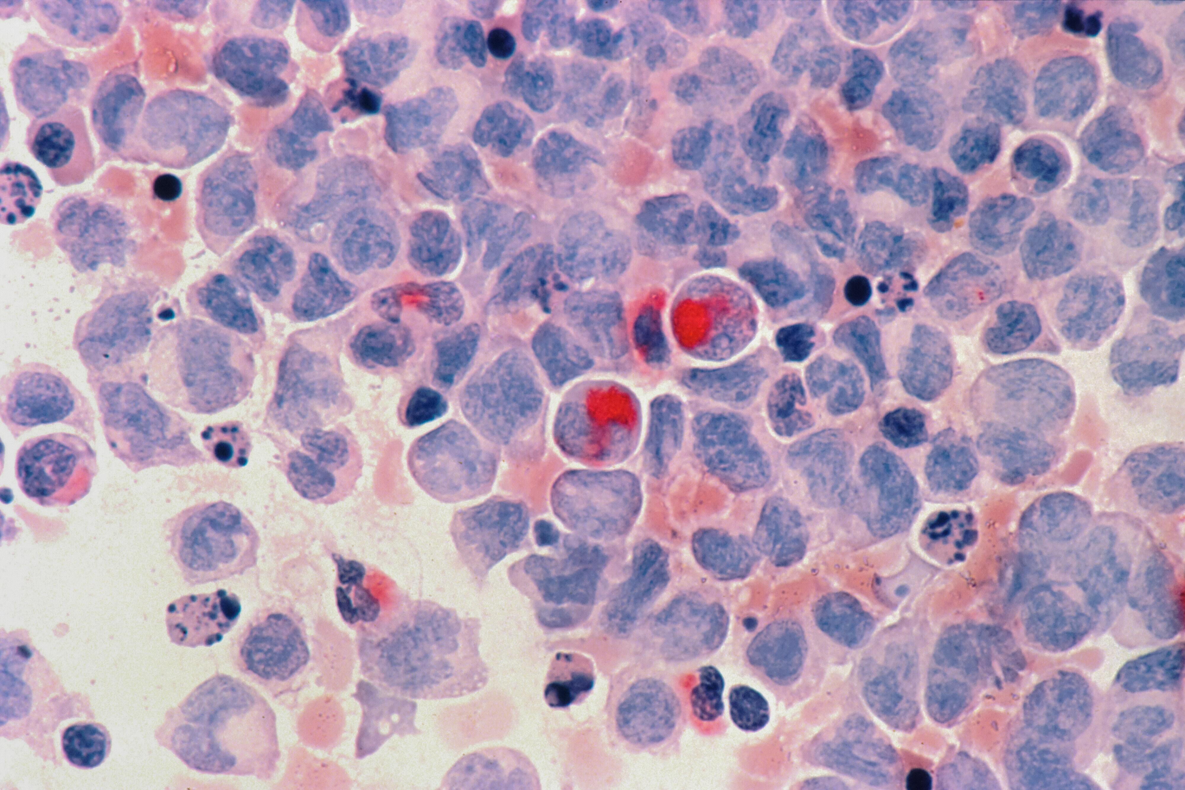 national-cancer-institute-mbL91Lg56zc-unsplash (1) (1) (1)